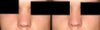Nosejob photoshop 4