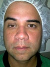 Before any surgery