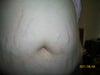 front view of abdomen