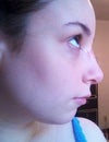 Moistness is from bacitracin. I figure it doesn't hurt to put on.