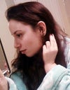 This is a picture 3 weeks post-op, to give you an idea of how I looked before I irritated it.