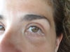 under eye circle in photos