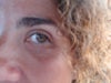 under eye circle