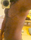 Side