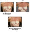 Visible bones inbetween breasts