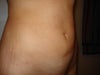 Stomach 2