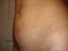 Stomach 3