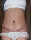 rt side very swollen