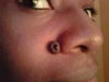 Closeup