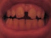 gap