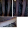 right and left legs