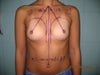 pre operation