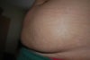 close up of skin and stretch marks