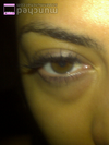 pic of my eyebags.