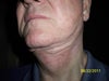 neck