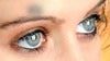 black mark on left eye top