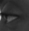 Left eye side view