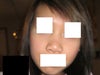 My nose is too big for my face.