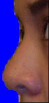 Left side (different from right)
