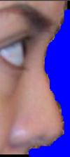 Right side (asymmetry from left)