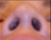Up the Nose