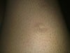 The coloring around the scar is darker than in the picture.