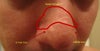 12 year scar bump in front.