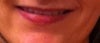 After braces-can't event see teeth