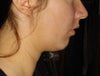 Profile view