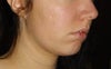 Partial profile view - notice my mouth has trouble closing completely