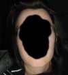 Front view of my face and jaw shape