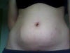 front on, looks like i have had a c-section but i havent :-(