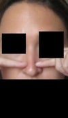 Showing you where my nose pretty much just starts to feel all cartilage/no bone.