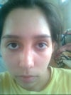 I feel like my bridge is sunken in and it makes my eyes look too spread apart
