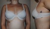 36b bra