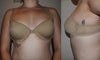 36c bra