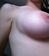 right breast, arm not raised