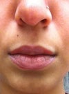 Assymetrical nostrils