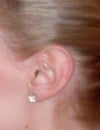 My ear
