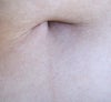 hair around my belly button (after shaving 1 before you can already see it)