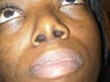 nostril