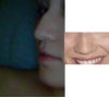 Side and front