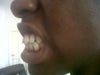 My Teeth
