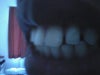 My Teeth