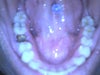 The bottom Where im missing my tooth