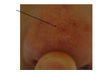 arrow shows dent