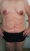 Before front