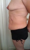 Before side view
