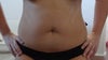 front view tummy