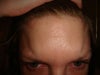 lose up showing attempt to furrow brows which enhances bulge and muscular outline.